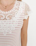 g-dz fashion Tricou Roz de Bumbac cu mânecă scurtă cu Dantelă Decorativă la Decolteu Carines