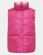 Kids Only Vestă New Ricky 15306414 Regular Fit