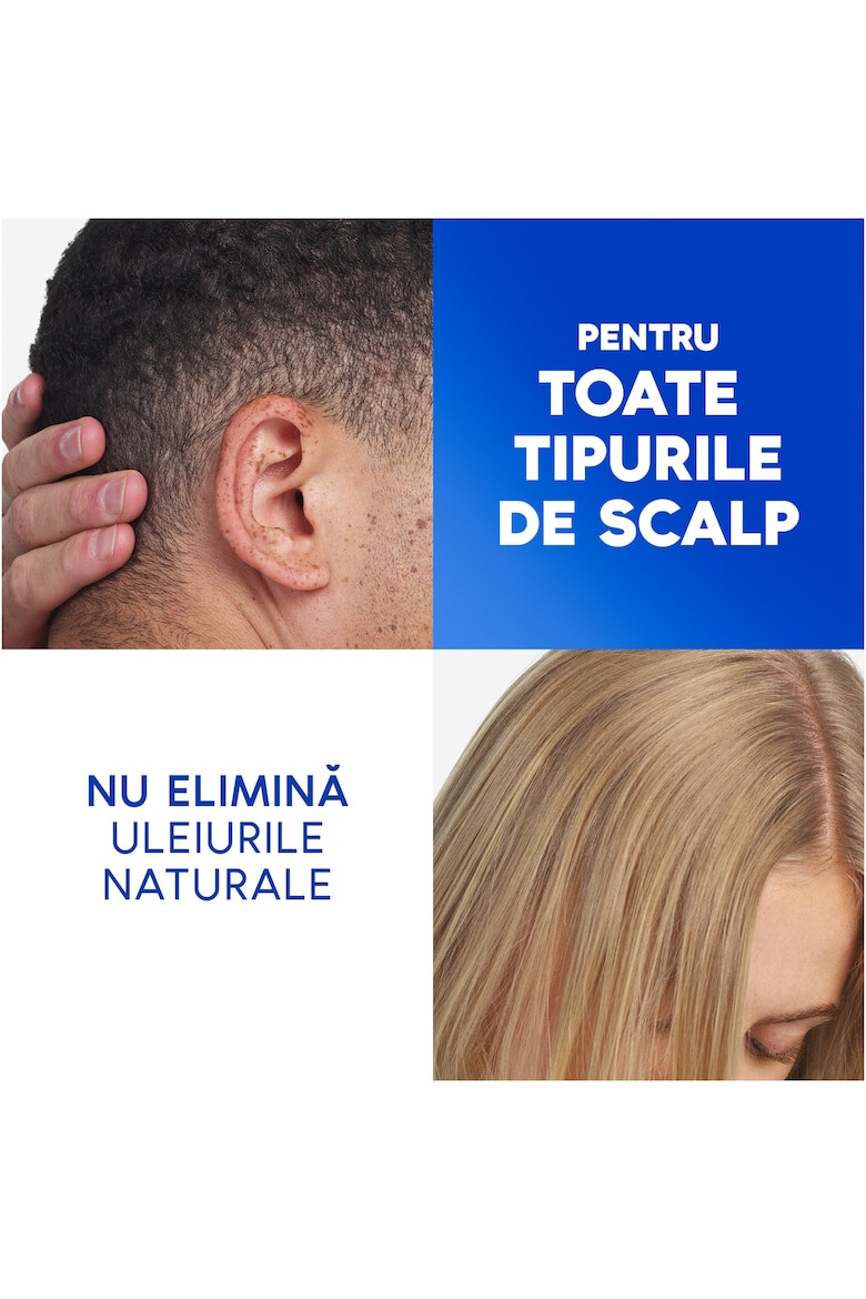 Head&Shoulders Sampon anti-matreata Head & Shoulders Citrus Fresh pentru par gras - Pled.ro